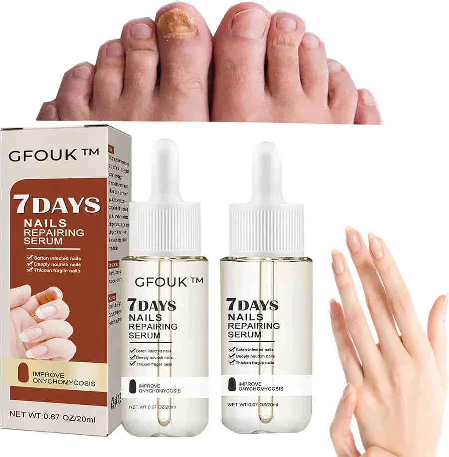 NAILS REPAIRER® | SUERO REPARADOR DE UÑAS