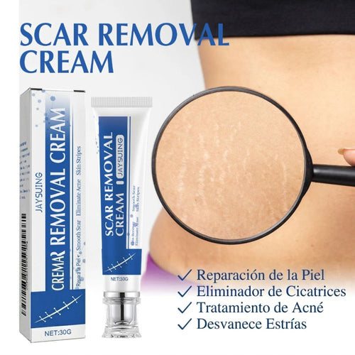 SCAR REMOVAL CREAM - Reduce cicatrices y suaviza tu piel ✨