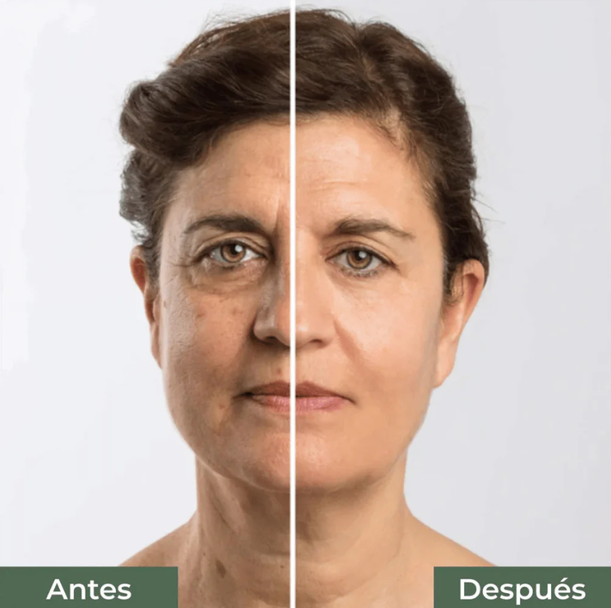 SERUM ANTI ARRUGAS | SUPER EFECTIVO