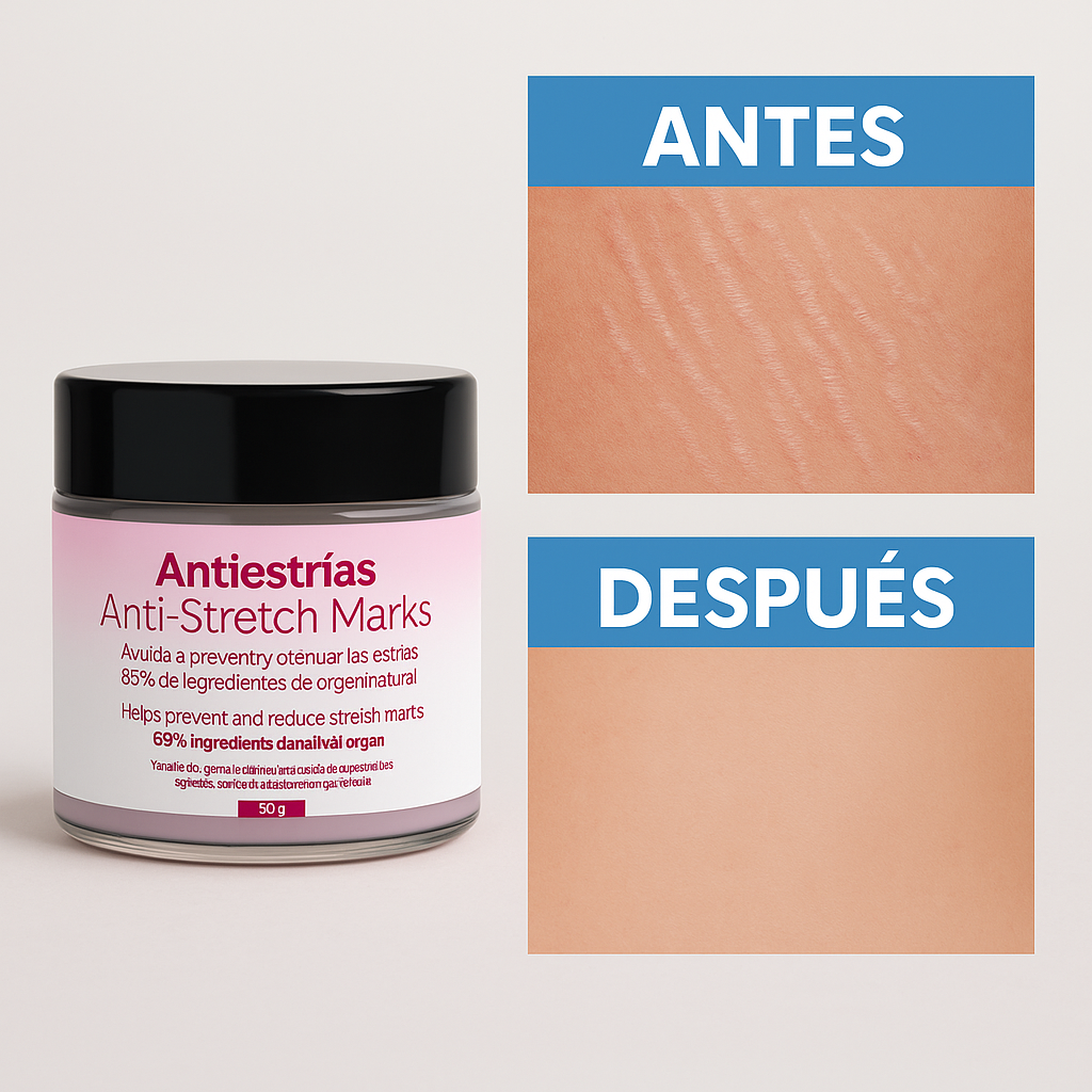 Crema Antiestrías ANTISTRETCH - ¡Resultados Visibles en 7 Días!