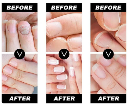 COMBO SALUD | SERUM REPARADOR + PARCHE CORRECTOR PARA UÑA