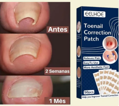 COMBO SALUD | SERUM REPARADOR + PARCHE CORRECTOR PARA UÑA