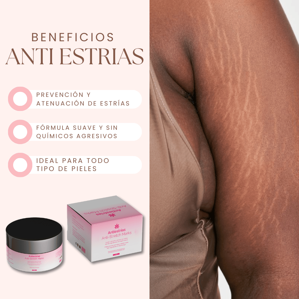 CREMA ANTI ESTRÍAS